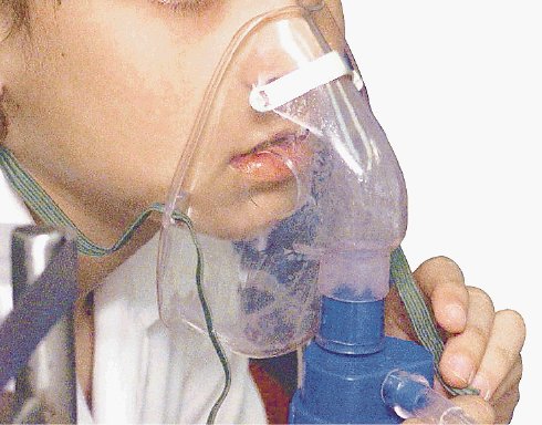  Buscan mejor atención en asma y diarreas. El diagnóstico y manejo del asma se estandarizará. Archivo.