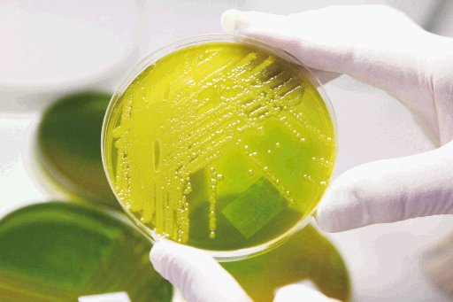  Peligrosa bacteria mata a 10 en Alemania. Los científicos estudian la bacteria asesina.EFE.