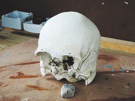 Se llevaron un cráneo a la casa. Podría tener entre 5 y 6 años. Alfonso Quesada.
