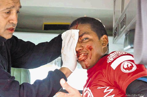  “Cali” se accidentó en Chile. Carlos terminó con dos cortaduras en su cara. FCS.