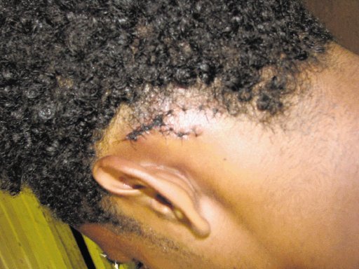  Joven sobrevive a ataque de lagarto Menor sufrió heridas en espalda y cuello