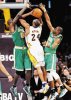  Lakers ganaron clásico de la NBA. Pese a su lesión en la cara, Kobe jugó agresivo.AP.