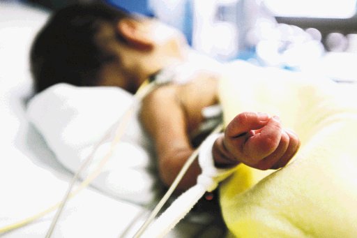  Mortalidad en cirugías cardíacas bajó un 50% Según médicos del Hospital Nacional de Niños